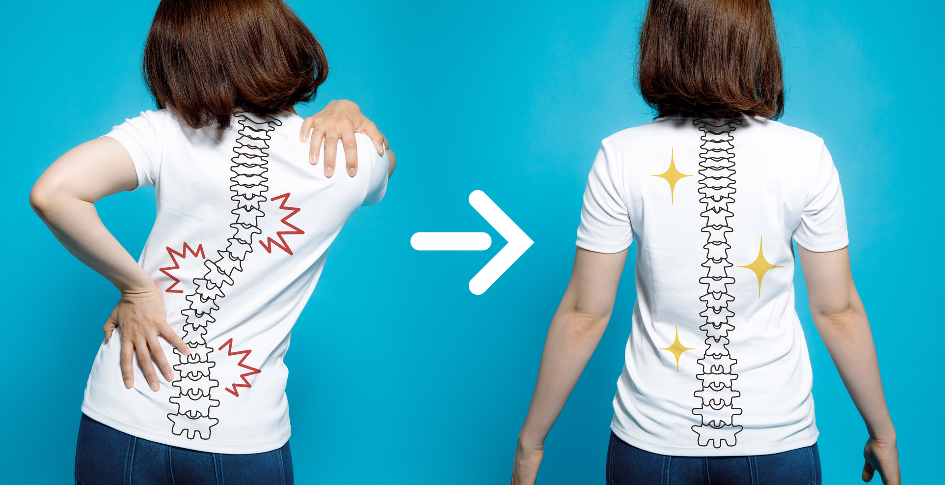 chiropractic-before-after-image-from-bad-posture-to-good-posture-womans-body-and-backbone